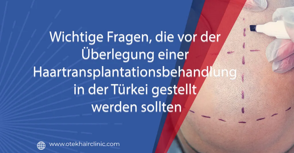 wichtige fragen die vor der ueberlegung einer haartransplantationsbehandlung in der tuerkei gestellt werden sollten