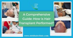 A Comprehensive Guide How is Hair Transplant Performed