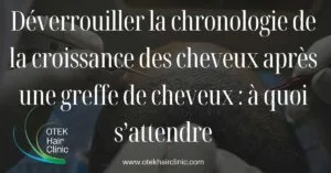 Blog-Fr 50 Deverrouiller la chronologie de la croissance des cheveux apres une greffe de cheveux a quoi sattendre