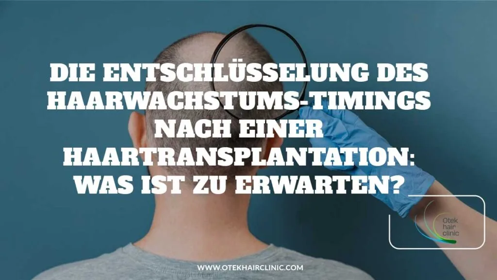 Die Entschlüsselung des Haarwachstums-Timings nach einer Haartransplantation: Was ist zu erwarten? 2 Die Entschlusselung des Haarwachstums Timings nach einer Haartransplantation Was ist zu erwarten