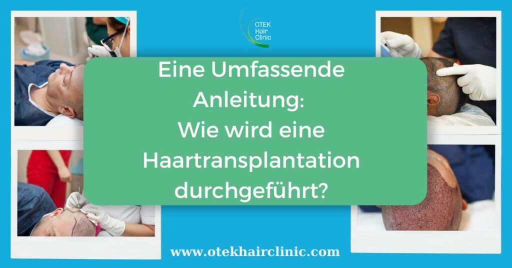Eine Umfassende Anleitung: Wie wird eine Haartransplantation durchgeführt?