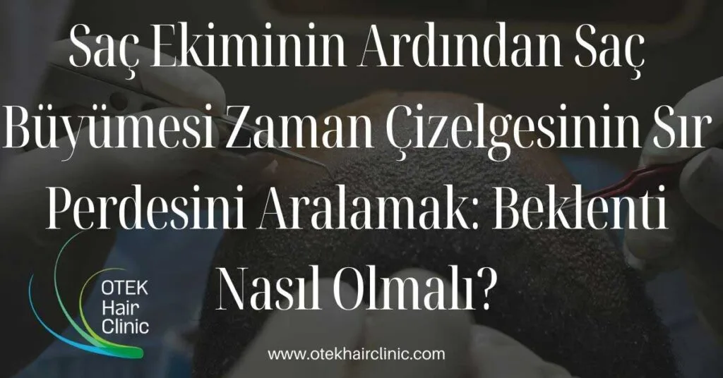 Sac Ekiminin Ardindan Sac Buyumesi Zaman Cizelgesinin Sir Perdesini Aralamak Beklenti Nasil Olmali