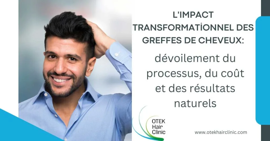 L'impact transformationnel des greffes de cheveux: dévoilement du processus, du coût et des résultats naturels 19 Limpact transformationnel des greffes de cheveux devoilement du processus du cout et des resultats naturels