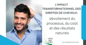 Blog-Fr 44 Limpact transformationnel des greffes de cheveux devoilement du processus du cout et des resultats naturels