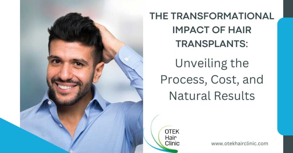 The Transformational Impact of Hair Transplants Unveiling the Process Cost and Natural Results