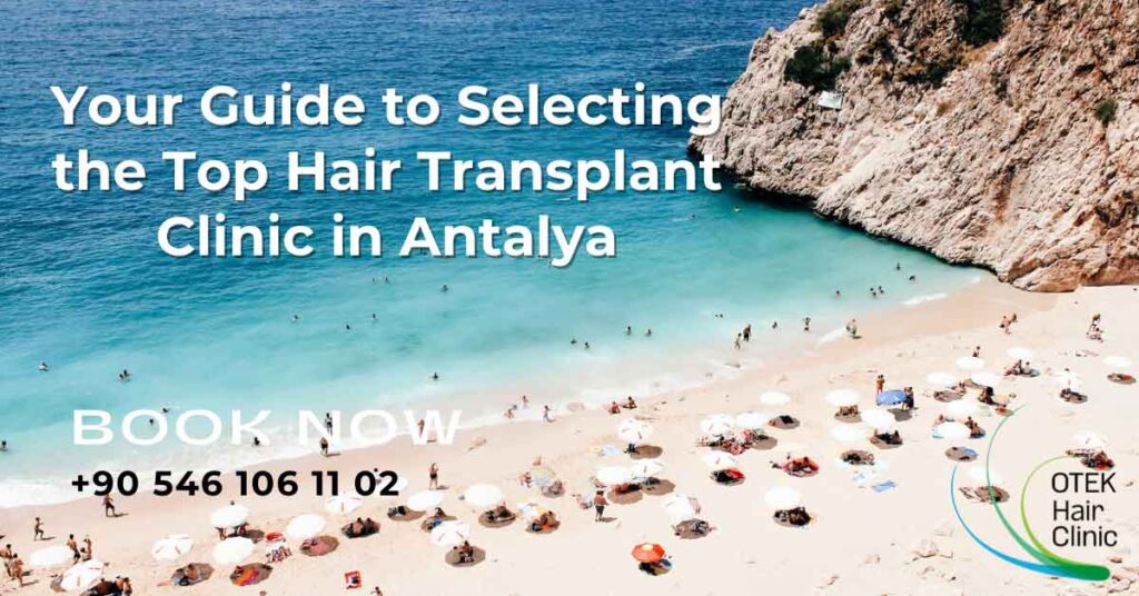 Your Guide to Selecting the Top Hair Transplant Clinic in Antalya