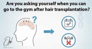 Are you asking yourself when you can go to the gym after hair transplantation 1