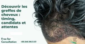 Blog-Fr 42 Decouvrir les greffes de cheveux timing candidats et attentes