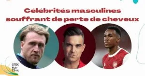 Blog-Fr 37 Celebrites masculines souffrant de perte de cheveux