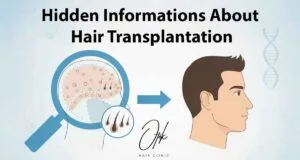 Hidden Informations About Hair Transplantation 1