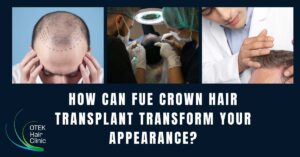 How Can FUE Crown Hair Transplant Transform Your Appearance