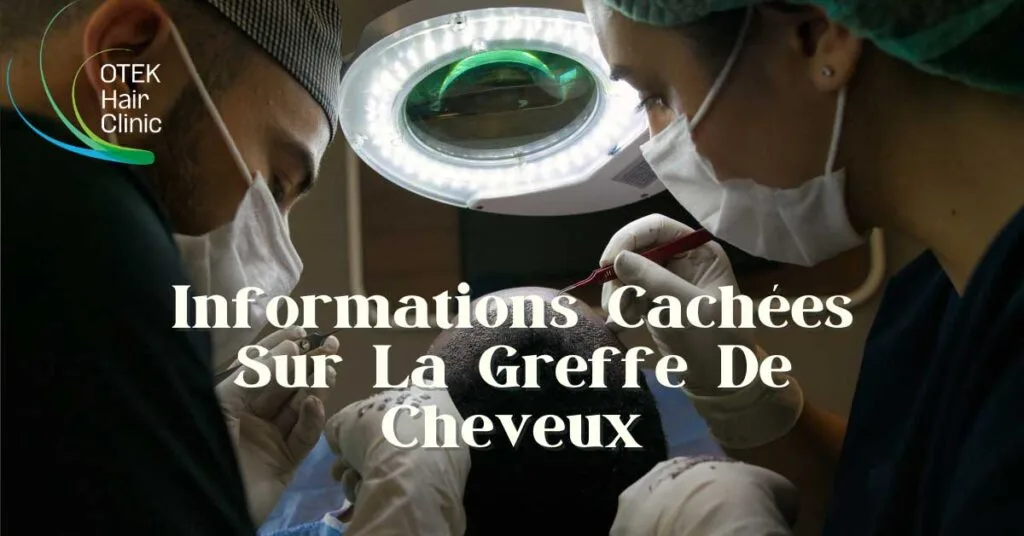 Informations Cachées Sur La Greffe De Cheveux 2 Informations Cachees Sur La Greffe De Cheveux