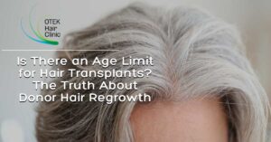 Is There an Age Limit for Hair Transplants The Truth About Donor Hair Regrowth