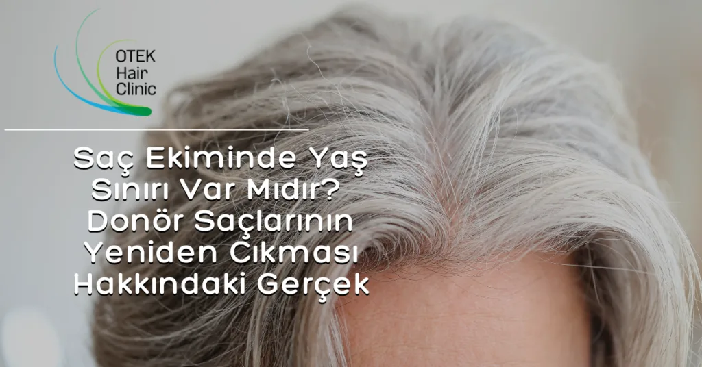 Saç Ekiminde Yaş Sınırı Var Mıdır? Donör Saçlarının Yeniden Çıkması Hakkındaki Gerçek 2 Sac Ekiminde Basari Bilmeniz Gerekenler 1200 × 628 piksel