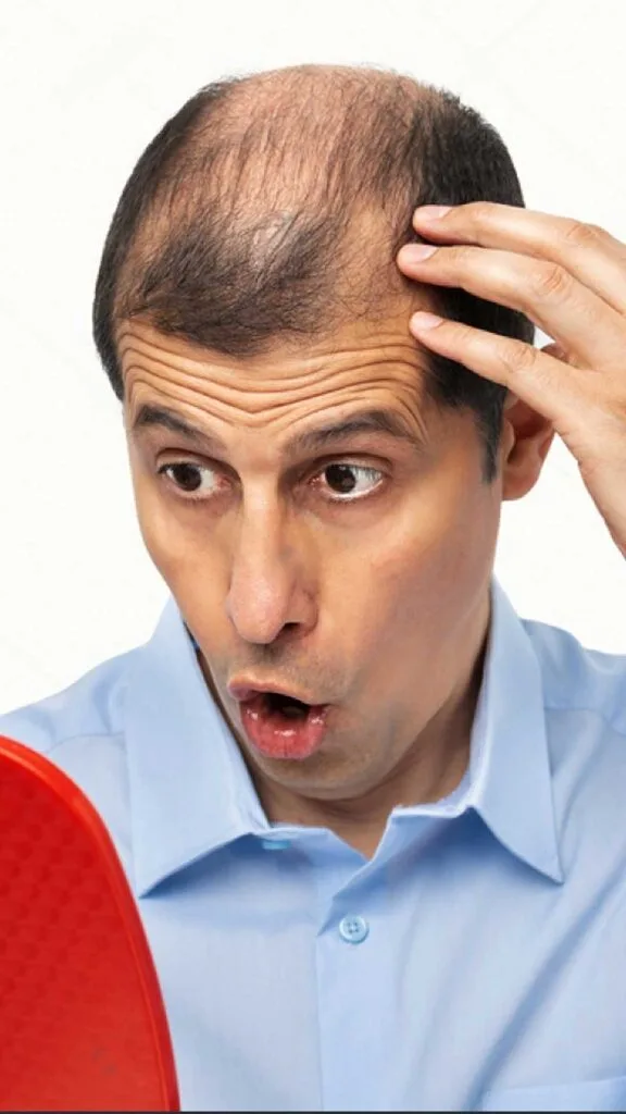 Discovering Hair Transplants: Timing, Candidates and Expectations 4 hair loss growth