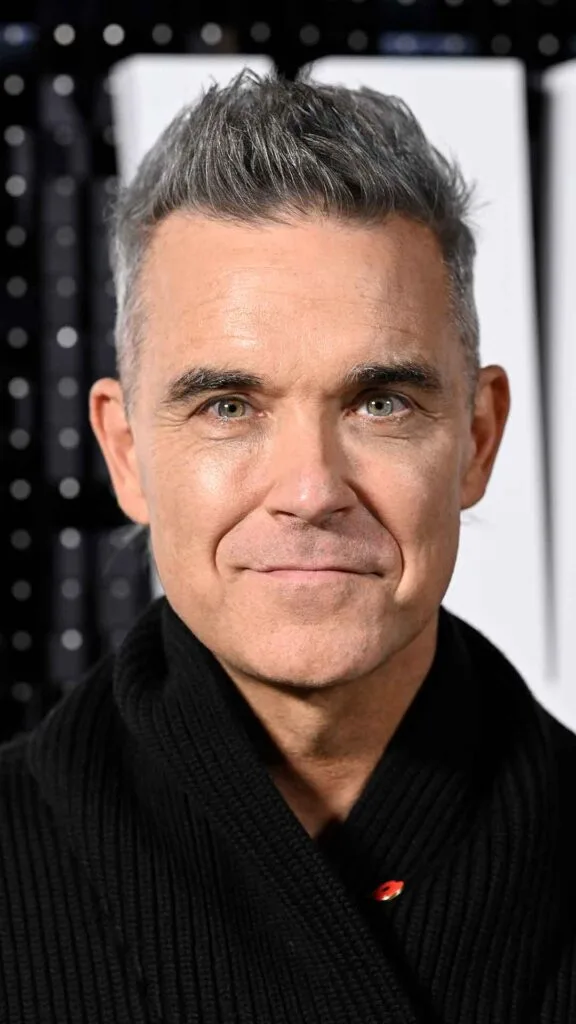 Male Celebrities With Hair Loss 6 robiie willams
