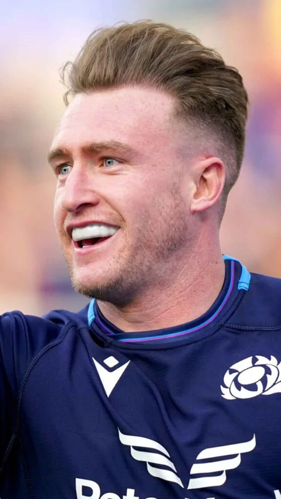 Male Celebrities With Hair Loss 4 stuart hogg