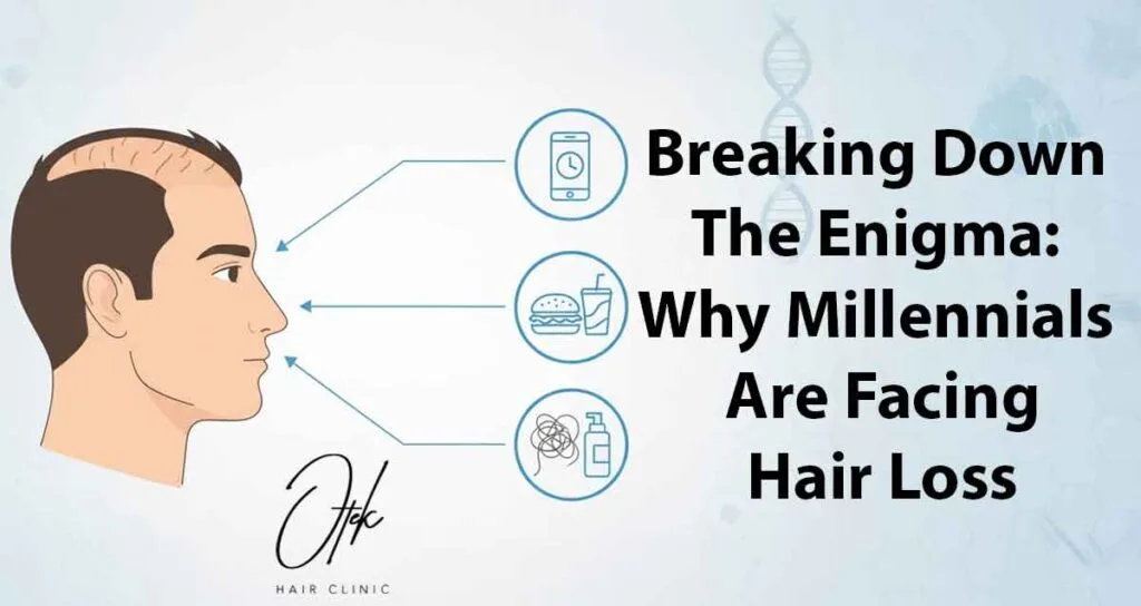 Breaking Down the Enigma: Why Millennials Are Facing Hair Loss 21 Breaking Down the Enigma Why Millennials Are Facing Hair Loss 1