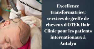 Excellence transformatrice services de greffe de cheveux dOTEK Hair Clinic pour les patients internationaux a Antalya