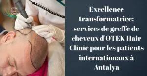 Blog-Fr 31 Excellence transformatrice services de greffe de cheveux dOTEK Hair Clinic pour les patients internationaux a Antalya