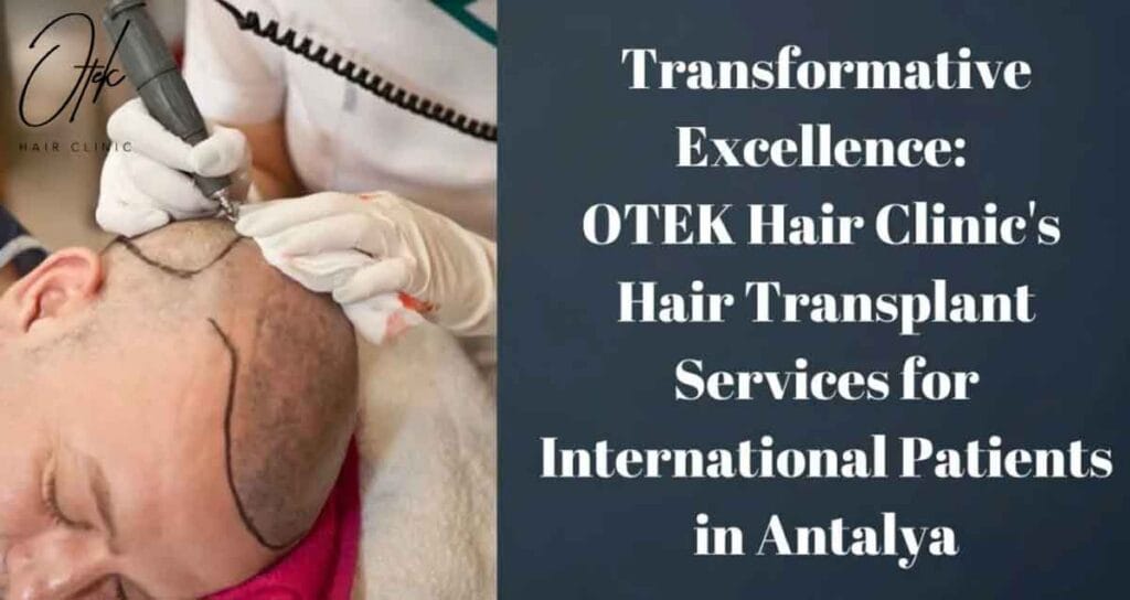 Transformative Excellence OTEK Hair Clinics Hair Transplant Services for International Patients in Antalya 1