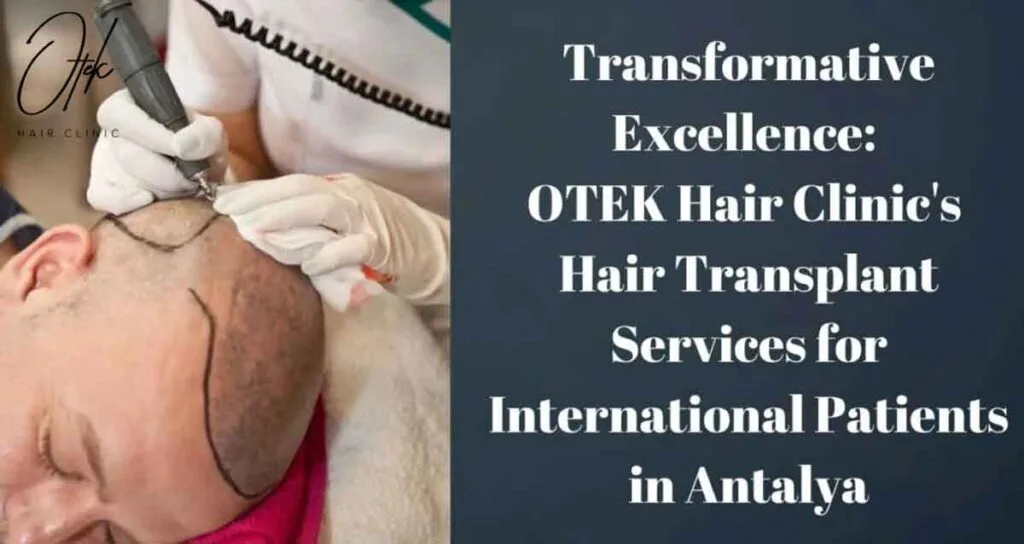 Transformative Excellence: OTEK Hair Clinic's Hair Transplant Services for International Patients in Antalya 8 Transformative Excellence OTEK Hair Clinics Hair Transplant Services for International Patients in Antalya 1