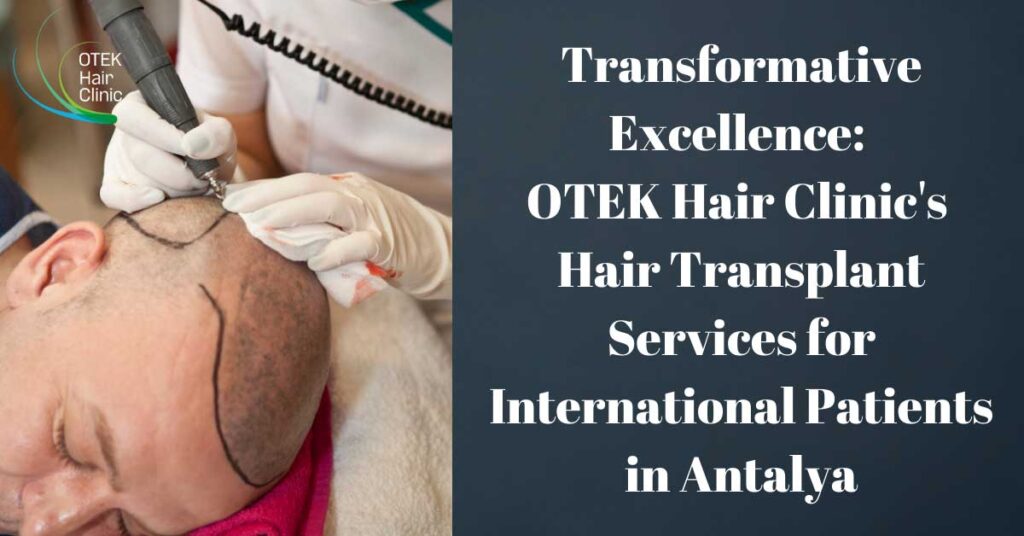 Transformative Excellence OTEK Hair Clinics Hair Transplant Services for International Patients in Antalya