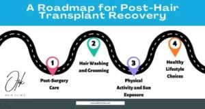 A Roadmap for Post Hair Transplant Recovery 1