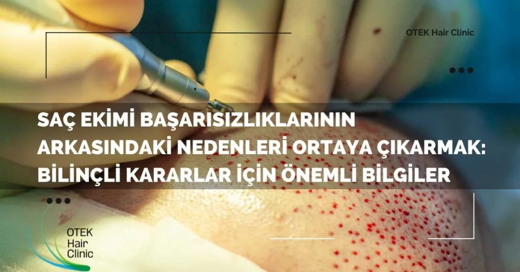 Saç Ekimi Başarısızlıklarının Arkasındaki Nedenleri Ortaya Çıkarmak: Bilinçli Kararlar İçin Önemli Bilgiler 13 Sac Ekimi Basarisizliklarinin Arkasindaki Nedenleri Ortaya Cikarmak Bilincli Kararlar Icin Onemli Bilgiler