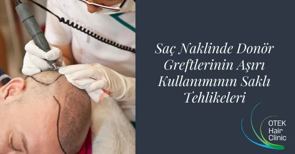 Saç Naklinde Donör Greftlerinin Aşırı Kullanımının Saklı Tehlikeleri 5 @otekhairclinic 1200 x 628 piksel 1