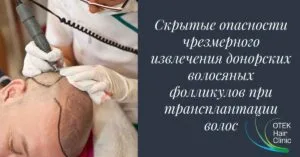 @otekhairclinic 1200 x 628 piksel 2