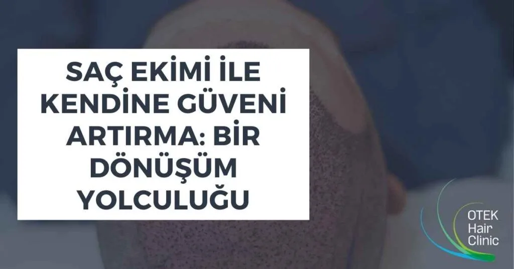 Saç Ekimi ile Kendine Güveni Artırma: Bir Dönüşüm Yolculuğu 1 Sac Ekimi ile Kendine Guveni Artirma Bir Donusum Yolculugu
