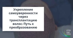 Блог 16 Укрепление самоуверенности через трансплантацию волос Путь к преобразованию