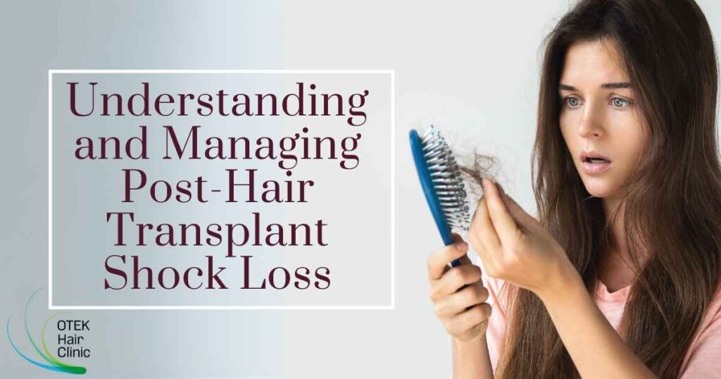 Understanding and Managing Post Hair Transplant Shock Loss